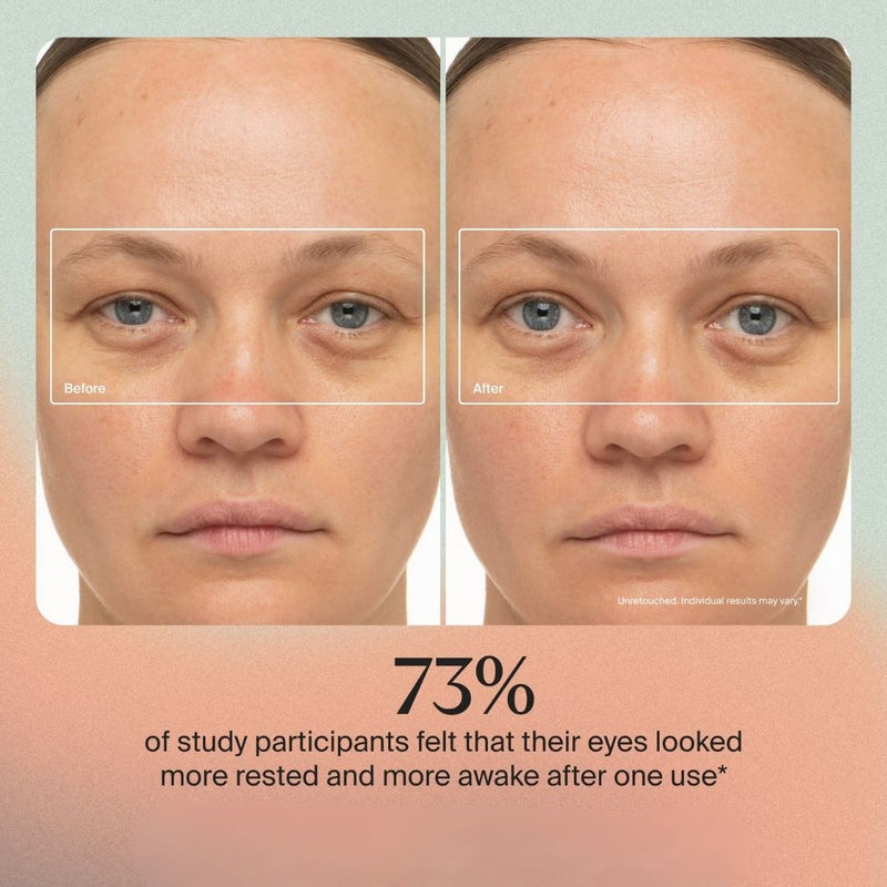 Nuvio EMS Patch Full Face Set