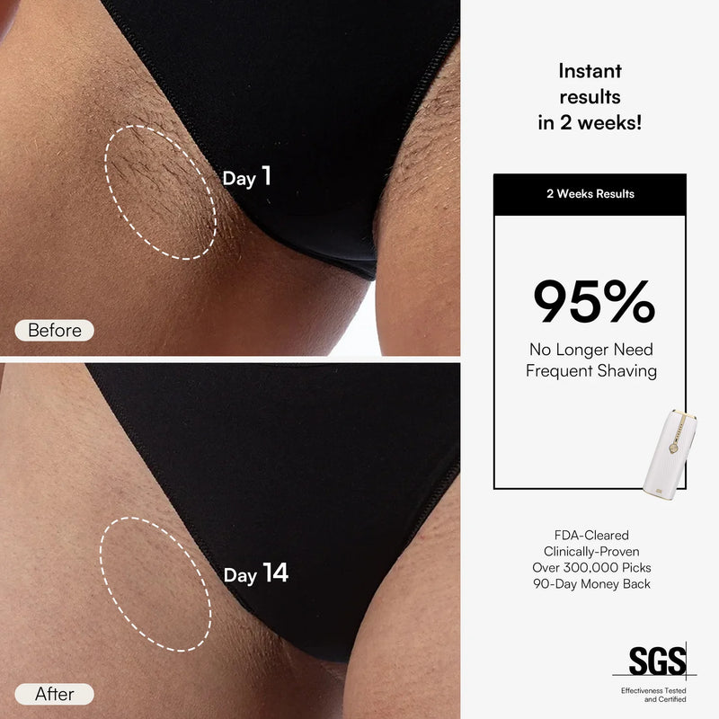 Nuvio IPL Hair Removal Device