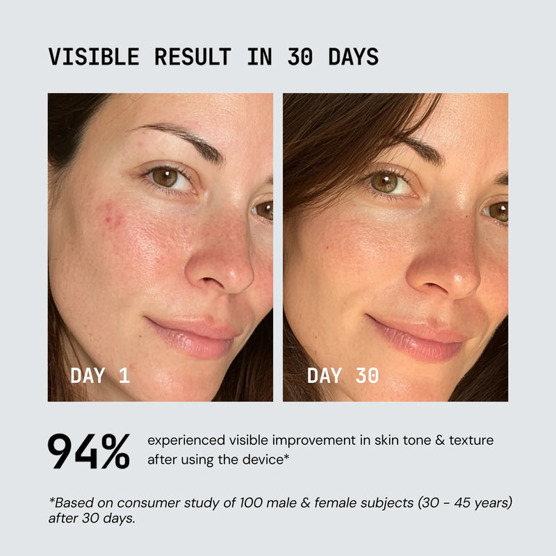 Nuvio Sonic Lift Wand