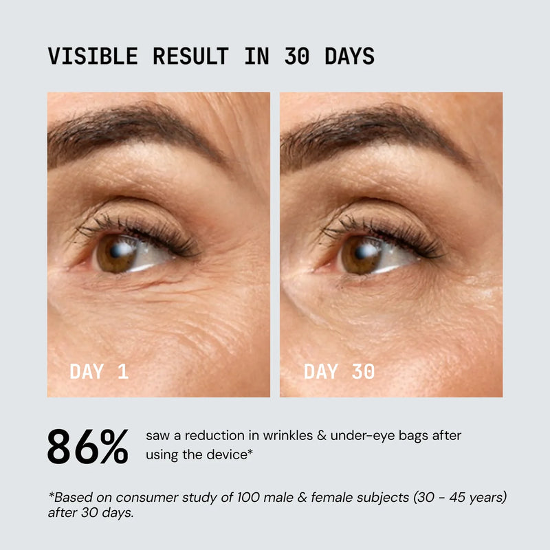 Nuvio Sonic Lift Wand